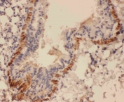 IHC testing of FFPE mouse lung tissue with Canstatin / Collagen IV antibody at 1ug/ml. Required HIER: steam section in pH6 citrate buffer for 20 min and allow to cool prior to staining.