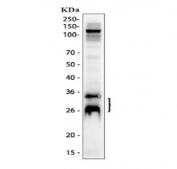 Western blot testing of human placental tissue lysate with Canstatin / Collagen IV antibody at 0.5ug/ml. Expected molecular weight of Canstatin: 24-30 kDa.