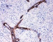 IHC testing of FFPE rat kidney tissue with Canstatin / Collagen IV antibody at 1ug/ml. Required HIER: steam section in pH6 citrate buffer for 20 min and allow to cool prior to staining.