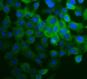 Immunofluorescent staining of human A431 cells with Canstatin / Collagen IV antibody (green) and DAPI nuclear stain (blue).