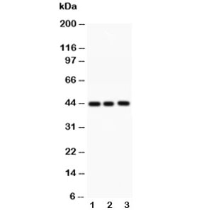 Caspase-1 antibody and 1. MCF-7, 2. HeLa, 3. SW620 lysate testing by western blot~