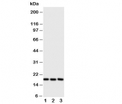 Western blot testing of I-309 antibody and Lane 1:  SCG;  2: COLO320;  3: Jurkat cell lysate.  Expeced size ~11KD, observed size ~17KD