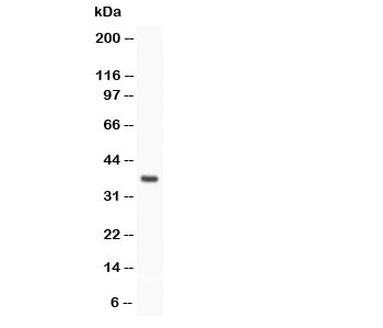 Western blot testing of Stra8 antibody and rat testis; Predicted size: 37KD; Observed size: 37KD