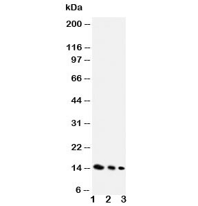 Western blot testing of IL-4 antibody and Lane 1: recombinant mouse protein 10ng; 2: 5ng; 3: 2.5ng