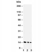 Western blot testing of IL-4 antibody and Lane 1:  recombinant mouse protein 10ng;  2: 5ng;  3: 2.5ng. Expected molecular weight: 14-20 kDa depending on glycosylation level.