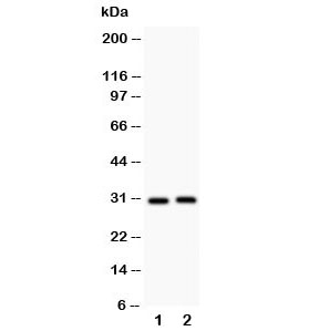 Western blot testing of IL-1b antibody and Lane 1: rat spleen; 2: rat thymus; Predicted size: 31KD; Observed size: 31KD