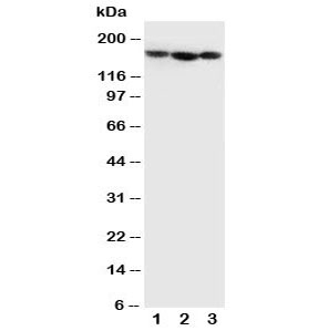 Western blot testing of Collagen IV antibody and Lane 1: MCF-7; 2: SCG; 3: SW620 cell lysate