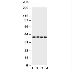 Western blot testing of ATF4 antibody and Lane 1: A431; 2: Raji; 3: CEM; 4: HUT cell lysate