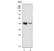 Western blot testing of human 1) Raji and 2) MOLT4 cell lysate with BCAT1 antibody. Predicted molecular weight ~43 kDa.