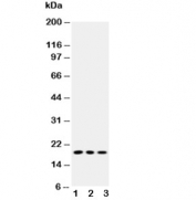 Western blot testing of Caveolin-2 antibody and Lane 1:  HeLa;  2: SMMC-7721;  3: COLO320 cell lysate. Predicted molecular weight ~18 kDa