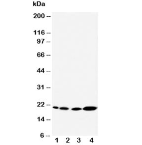 Western blot testing of Caveolin-2 antibody and Lane 1: rat heart; 2: rat lung; 3: HeLa; 4: A431 cell lysate