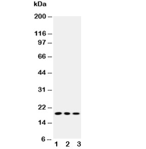 Western blot testing of Caveolin-2 antibody and Lane 1: HeLa; 2: SMMC-7721; 3: COLO320 cell lysate
