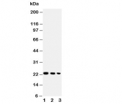 Western blot testing of BAFF antibody and Lane 1:  recombinant human protein 10ng;  2: 5ng;  3: 2.5ng