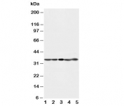 Western blot testing of CDK1 antibody and Lane 1:  HeLa;  2: 293T;  3: A431;  4: CEM;  5: Jurkat cell lysate. Predicted molecular weight: ~33 kDa.