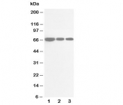 Western blot testing of CDC25B antibody and Lane 1:  rat brain;  2: rat kidney;  3: rat lung tissue lysate. Expected/observed molecular weight: 61~67kDa (isoforms 1-4).