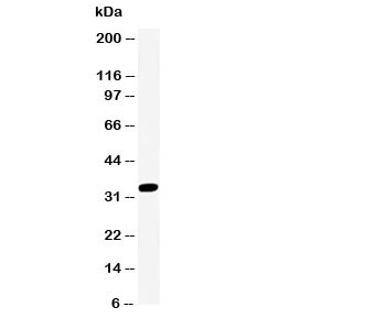 Western blot testing of Cdk2 antibody and Jurkat lysate; Predicted molecular weight ~33 kDa.