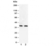 Western blot testing of Cdk5 antibody and Lane 1:  HeLa;  2: Jurkat cell lysate