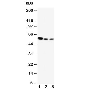Western blot testing of CD89 antibody and Lane 1: U87; 2: Raji; 3: Jurkat cell lysate