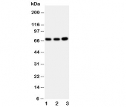 Western blot testing of GBP1 antibody and Lane 1:  U87;  2: HeLa;  3: MCF-7 cell lysate