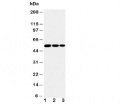 Western blot testing of IKK gamma antibody and Lane 1: mouse liver; 2: mouse brain; 3: mouse ovary tissue lysate. The protein is visualized from 37~60KD.