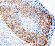 IHC-P: hCG receptor antibody testing of rat ovary tissue. HIER: steamed with pH6 citrate buffer.