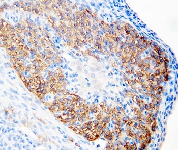 IHC-P: hCG receptor antibody testing of rat ovary tissue