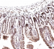 IHC staining of FFPE mouse intestinal tissue with CTBP2 antibody. HIER: boil tissue sections in pH6 citrate buffer for 20 min and allow to cool before testing.