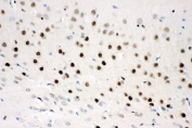 IHC staining of FFPE rat brain tissue with CTBP2 antibody. HIER: boil tissue sections in pH6 citrate buffer for 20 min and allow to cool before testing.