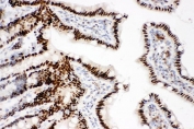 IHC staining of FFPE rat intestinal tissue with CTBP2 antibody. HIER: boil tissue sections in pH6 citrate buffer for 20 min and allow to cool before testing.