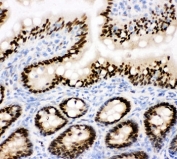 IHC staining of frozen rat intestinal tissue with CTBP2 antibody.