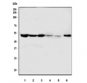 Western blot testing of 1) human K562, 2) human HepG2, 3) human ThP-1, 4) human HCCT, 5) rat liver and 6) mouse liver tissue lysate with Cystathionase antibody. Predicted molecular weight ~44 kDa.