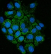 Immunofluorescent staining of FFPE human A431 cells with Cystathionase antibody (green) and DAPI nuclear stain (blue). HIER: steam section in pH6 citrate buffer for 20 min.