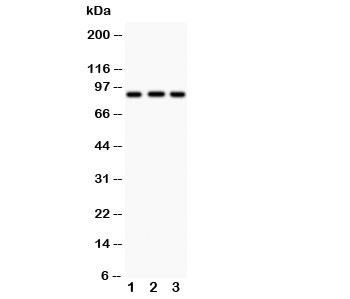 Western blot testing of CUL1 antibody and Lane 1: MM453; 2: HT1080; 3: SMMC-7721; Predicted size: 90 KD; Observed size: 90 KD