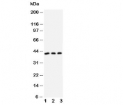 Western blot testing of DAPK2 antibody and Lane 1:  U87;  2: MCF-7;  3: SMMC-7721 cell lysate