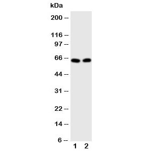 Western blot testing of E2F1 antibody and Lane 1: HeLa; 2: MCF-7 cell lysate. Predicted molecular weight: 48-60 kDa.