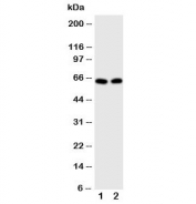 Western blot testing of E2F1 antibody and Lane 1:  HeLa;  2: MCF-7 cell lysate. Predicted molecular weight: 48-70 kDa.