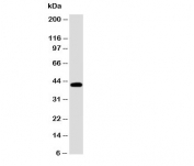 Western blot testing of EDA antibody and SW620 cell lysate