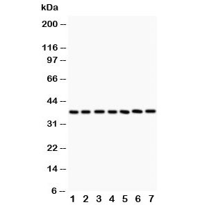 Western blot testing of LIF antibody and Lane 1: rat intestine; 2: (r) brain; 3: (r) spleen; 4: (r) thymus; 5: mouse brain; 6: (m) kidney; 7: (m) liver. The 180 amino acid protein is heavily glycosylated and is routinely visualized from 32~62KD.