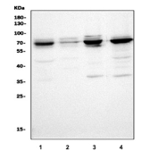 Western blot testing of 1) human HeLa, 2) human A431, 3) human HEK293 and 4) human Jurkat cell lysate with PAK1 antibody. The observed molecular weight of p21-activated kinase 1 is approximately 68-70 kDa.