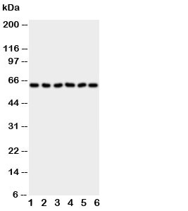 Western blot testing of PAK1 antibody and Lane 1: rat testis; 2: rat spleen; 3: SW620; 4: MCF-7; 5: CEM; 6: HT1080;