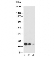 Western blot testing of SCF antibody and Lane 1:  recombinant human protein 10ng;  2:  5ng;  3: 2.5ng
