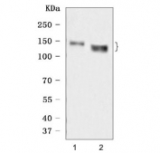 Western blot testing of human 1) A431 and 2) HACAT cell lysate with Desmoglein 3 antibody. Predicted molecular weight: 107 kDa but may be observed at higher molecular weights due to glycosylation.