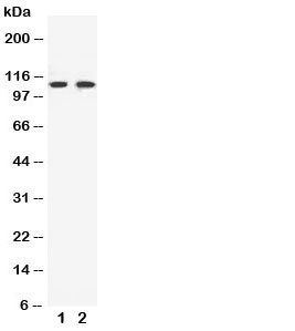 Western blot testing of EphB3 antibody and Lane 1: HeLa; 2: A549 cell lysate~