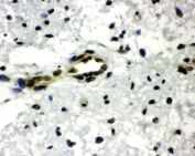 IHC-P: CTBP1 antibody testing of rat brain tissue. HIER: steamed with pH6 citrate buffer.