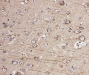 IHC-P: EphA1 antibody testing of rat brain tissue. HIER: steamed with pH6 citrate buffer.