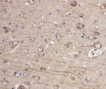 IHC-P: EphA1 antibody testing of rat brain tissue