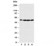 Western blot testing of Fascin antibody and Lane 1:  U87;  2: A549;  3: MCF-7;  4: HT1080 cell lysate. Predicted molecular weight ~55kDa.