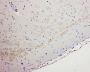 IHC testing of FFPE rat brain tissue with GABA A Receptor alpha 1 antibody at 1ug/ml. Required HIER: Boil the paraffin sections in 10mM citrate buffer, pH6, for 20min and let cool to RT.