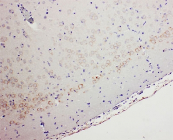 IHC testing of FFPE rat brain tissue with GABA A Receptor alpha 1 antibody at 1ug/ml. Required HIER: Boil the paraffin sections in 10mM cit