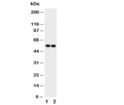 Western blot testing of GABA A Receptor alpha 1 antibody and Lane 1:  rat brain;  2: rat brain tissue lysate